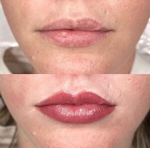 Permanent makeup Lips Noco Loveland Co